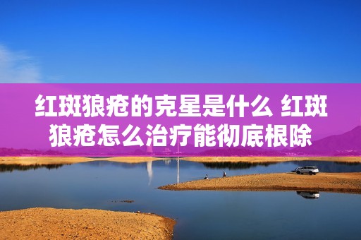 红斑狼疮的克星是什么 红斑狼疮怎么治疗能彻底根除